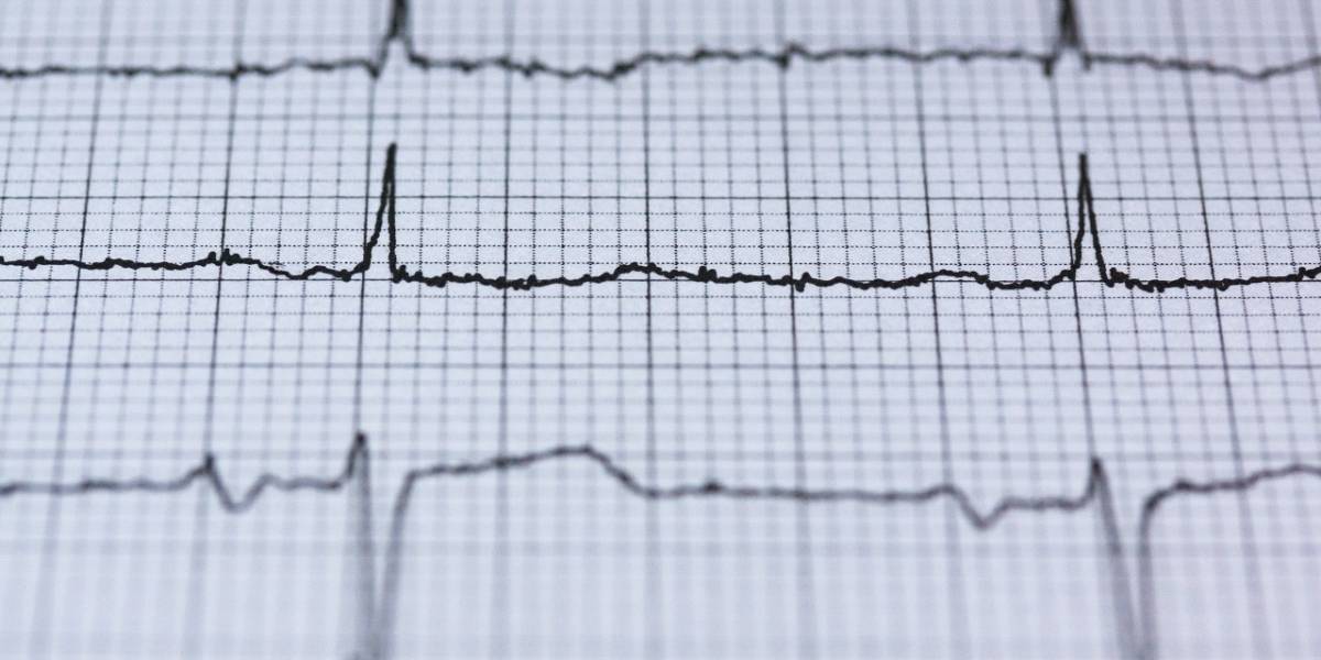 Utilizan Inteligencia Artificial para predecir riesgo de muerte en un año