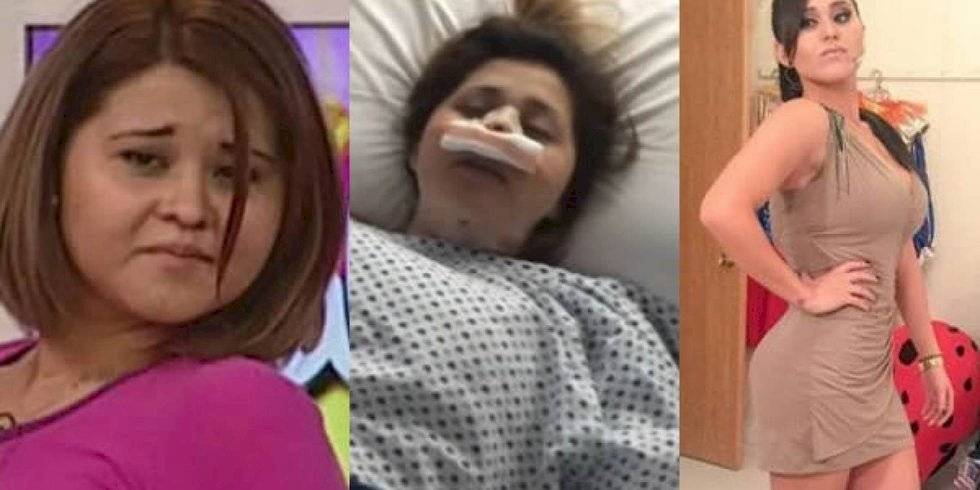 Gomita antes y después