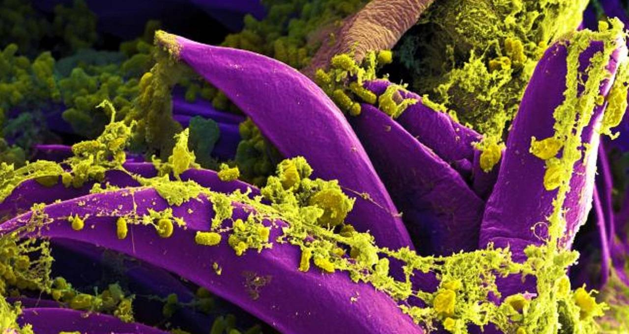 Confirmado tercer caso de Peste Negra en China