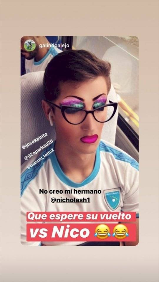 Nicholas Hagen víctima de los filtros de Instagram
