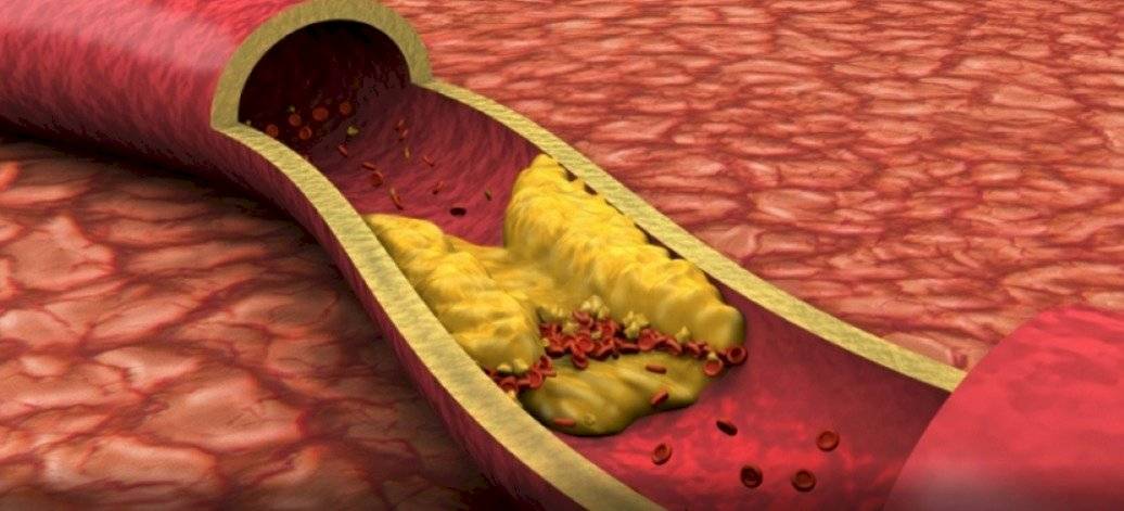 Colesterol