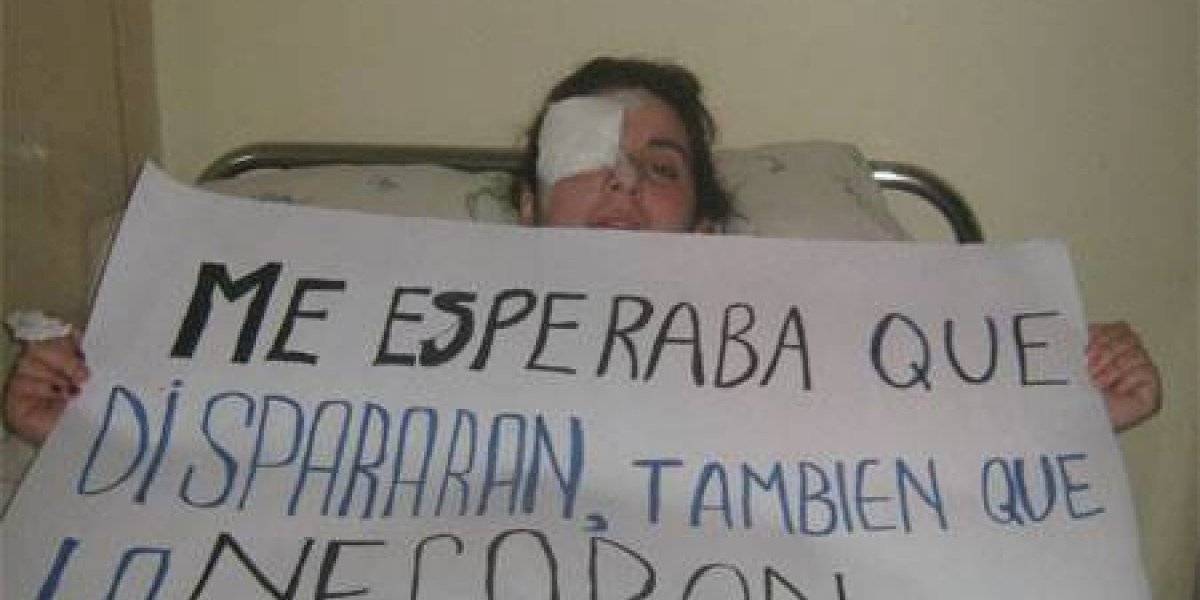USACH hace estudio que advierte que bombas lacrimógenas pueden provocar ceguera y lesiones oculares graves