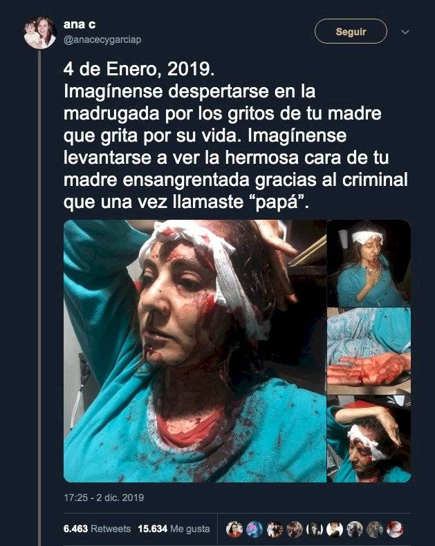 Abril Pérez Sagaón heridas