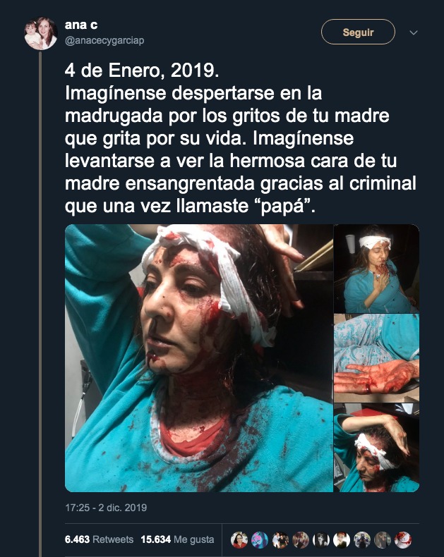Abril Pérez Sagaón heridas