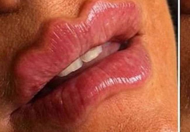 labios labios