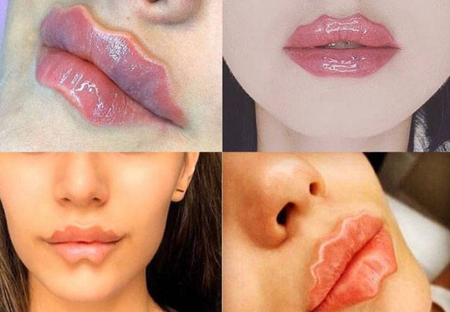 labios labios