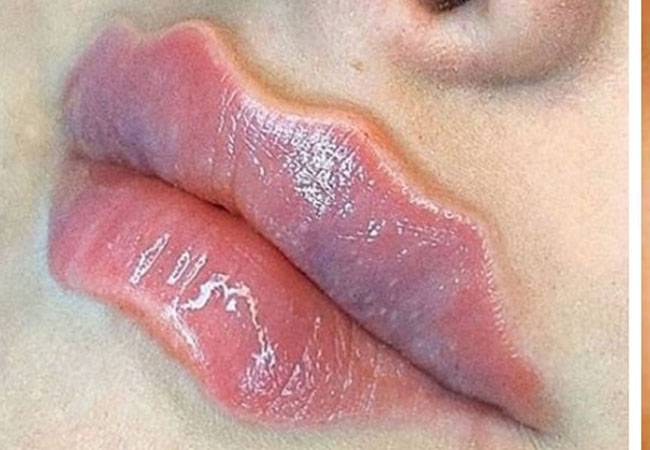 labios labios