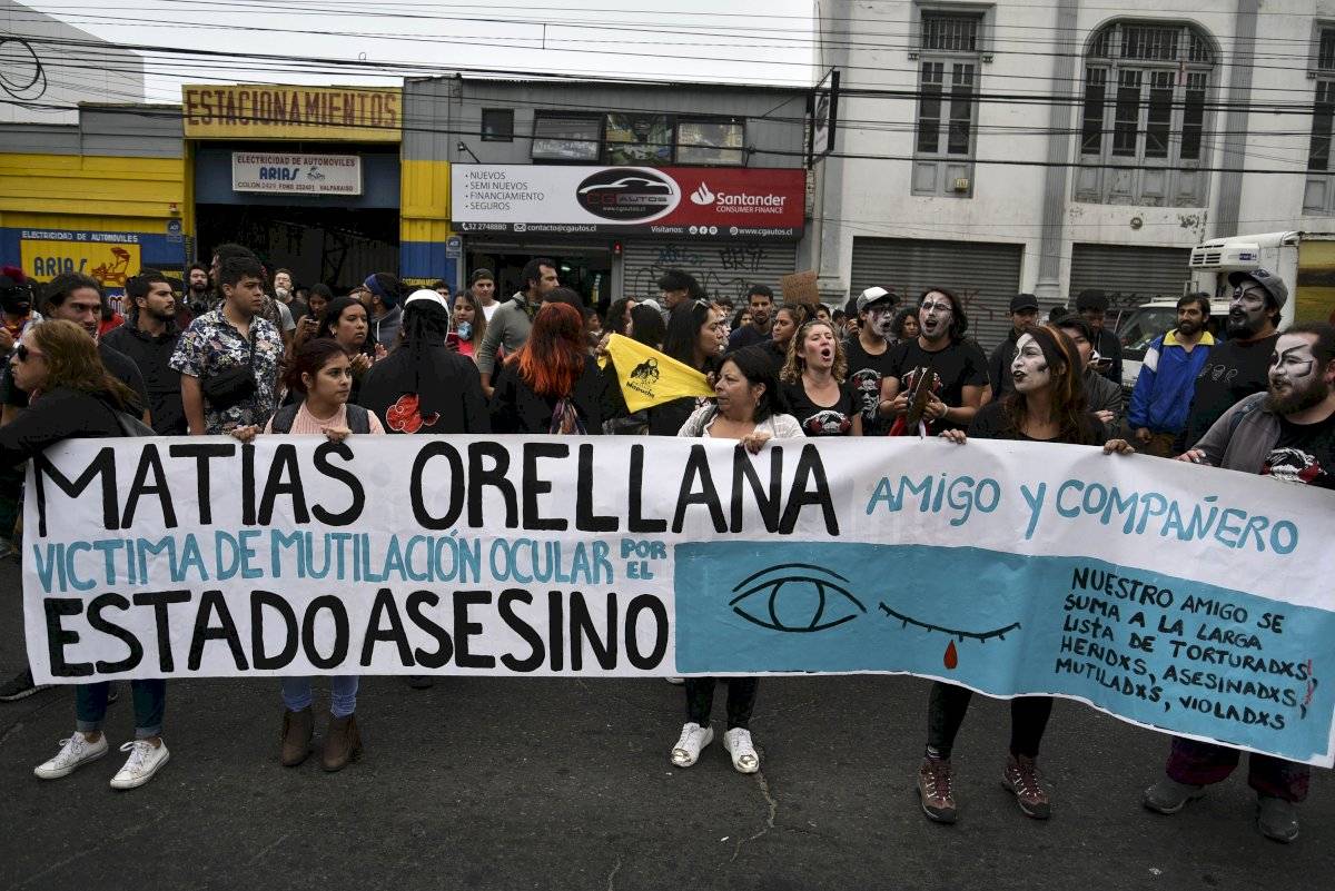 Manifestación joven perdió ojo