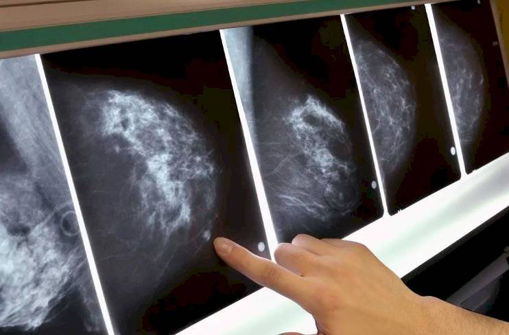 Cáncer: científicos presentan posible cura para la enfermedad obtenida desde el humano