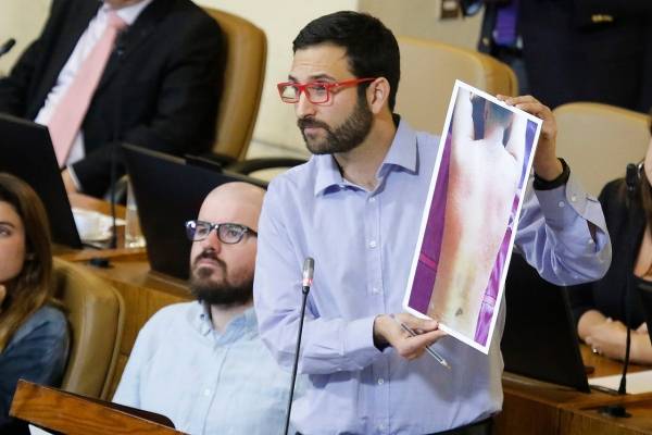 Diputado Crispi mostrando fotos de quemaduras