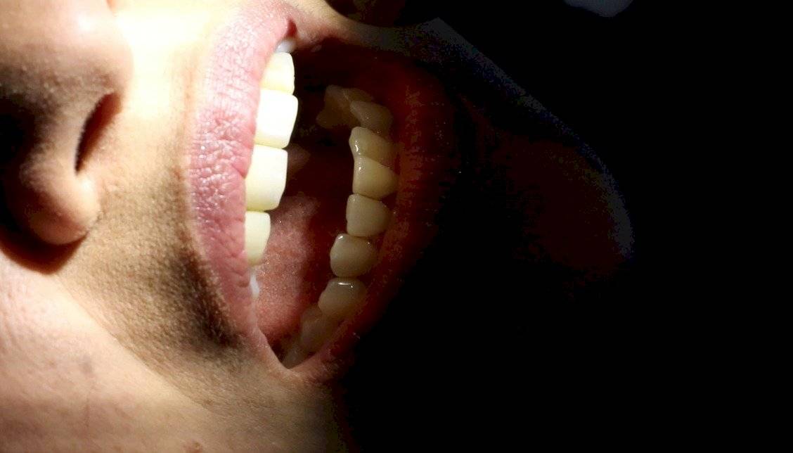 Revisión Dental