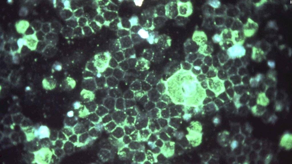 Coronavirus: ¿qué es la Cloroquina, la droga que está probando EE.UU contra la enfermedad?