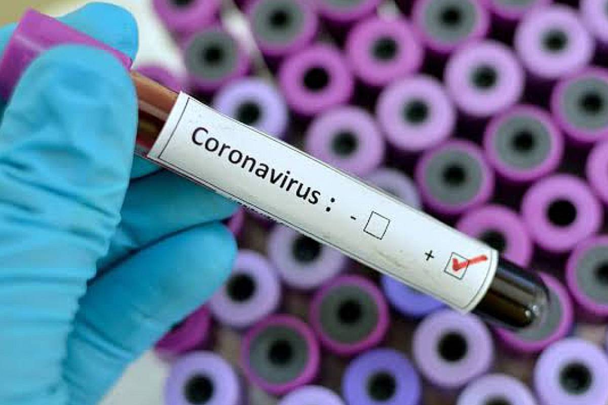 Resultado de imagen para coronavirus