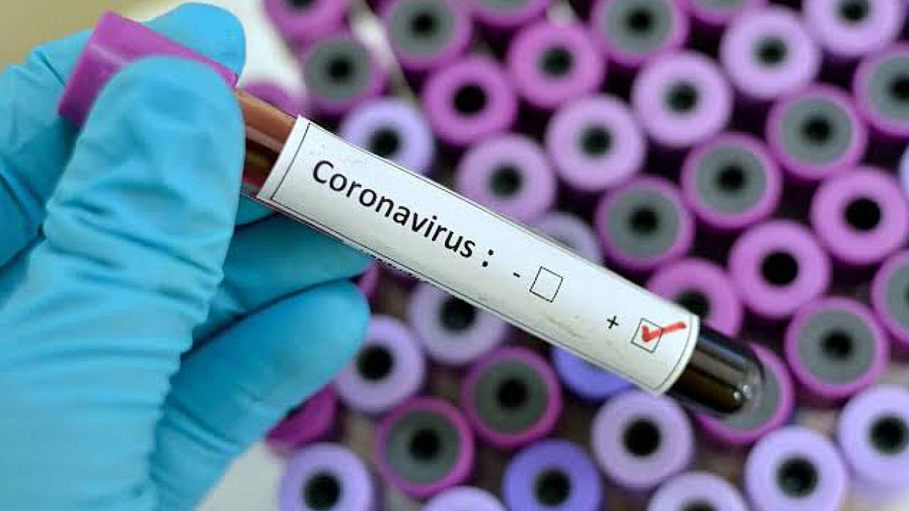 Coronavirus: estos son los efectos que tiene el virus a través del cuerpo Coronavirus: estos son los efectos que tiene el virus a través del cuerpo