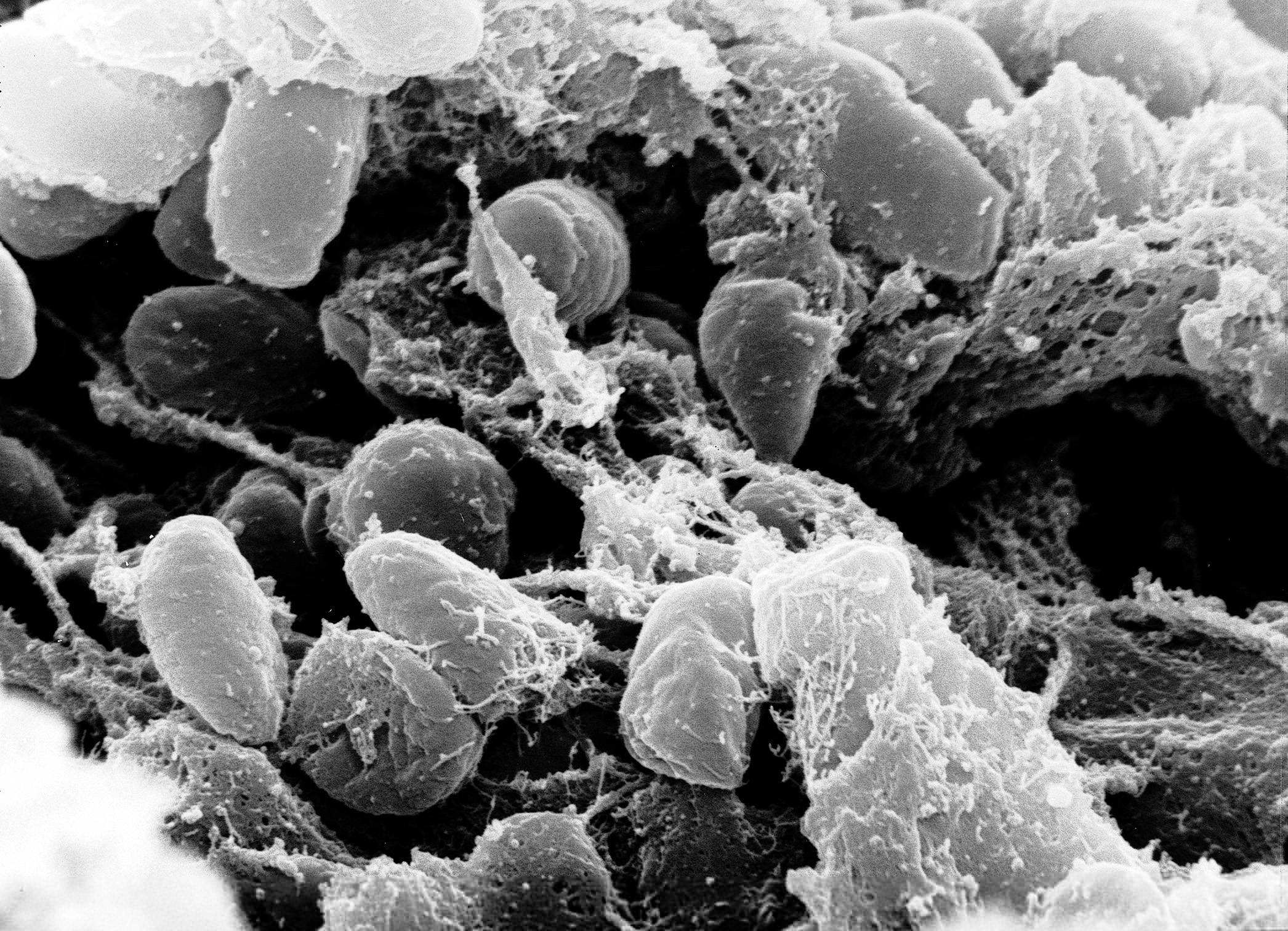 Coronavirus: conoce otras pandemias que han afectado a la humanidad en su historia Coronavirus: conoce otras pandemias que han afectado a la humanidad en su historia