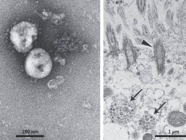 coronovirus