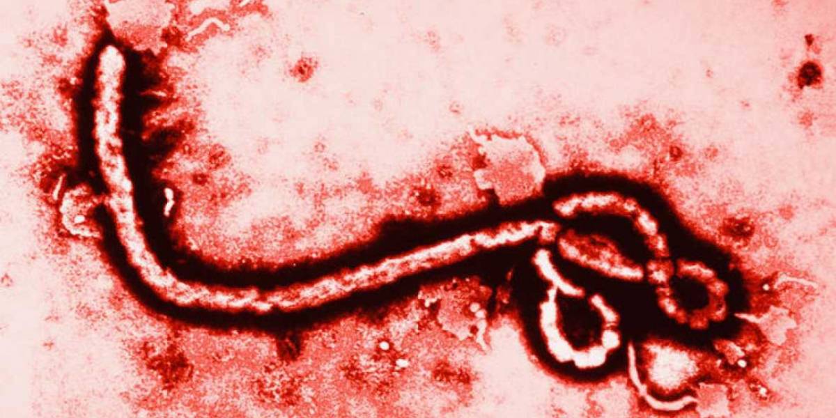 Ciencia: Están usando al virus del Ébola para combatir tumores cerebrales