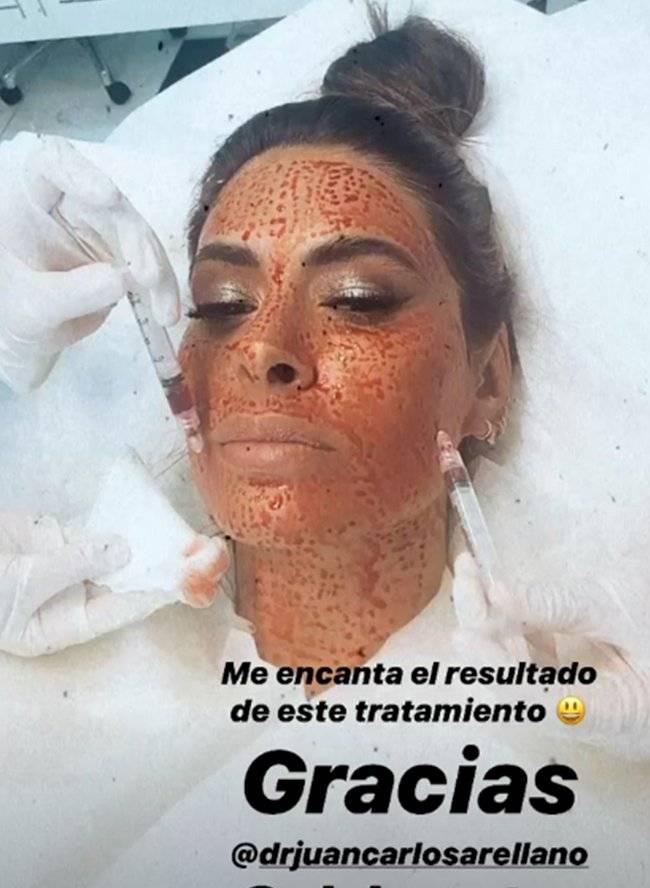 galilea