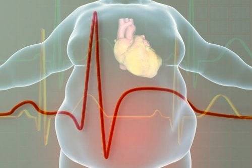 Coronavirus: nuevas investigaciones señalan que personas con sobrepeso son más propensas al COVID-19
