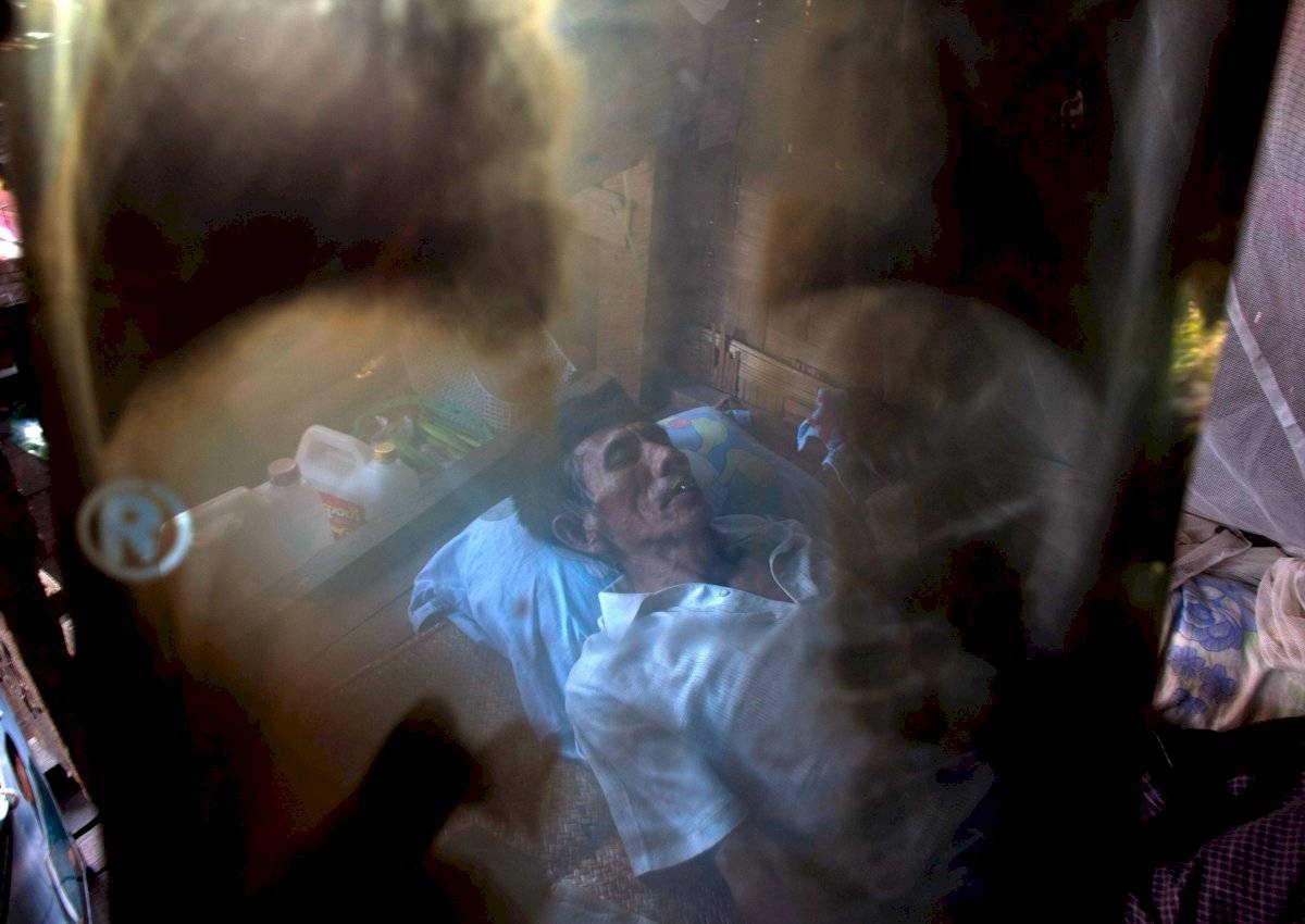 Tuberculosis