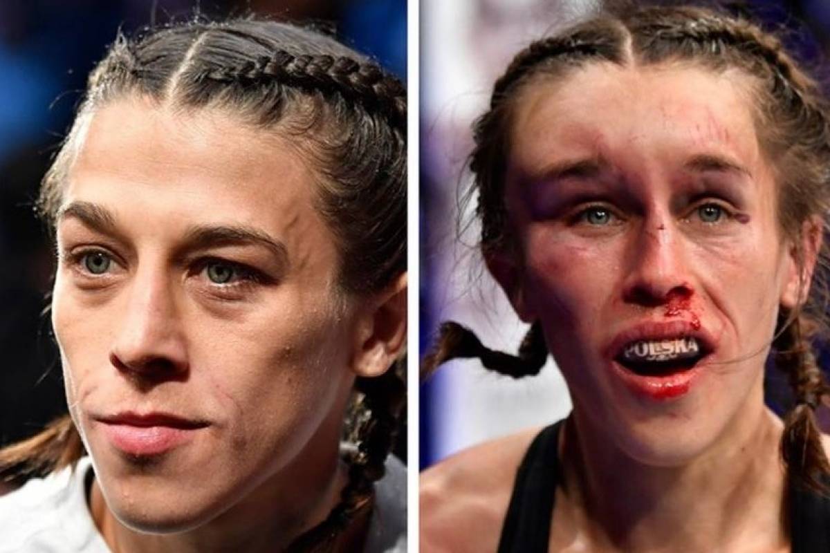 golpes en la cara de mujeres