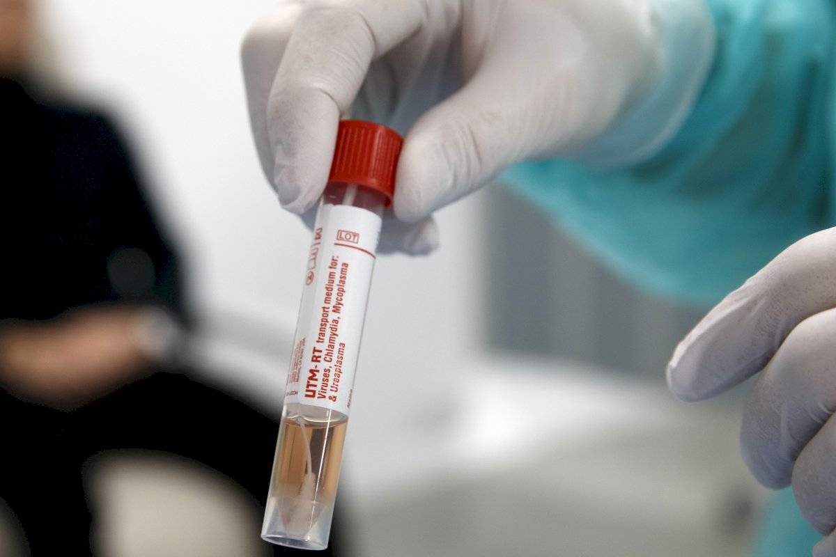 Imagen referencial/ Muestra de tubo nasofaríngeo recogido en una persona sospechosa de estar infectada con el coronavirus COVID-19