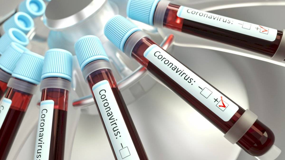 coronavirus