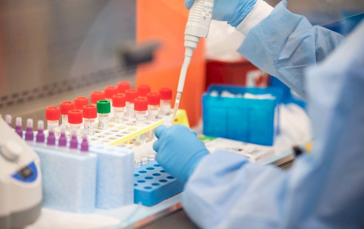 Laboratorio - cura - coronavirus