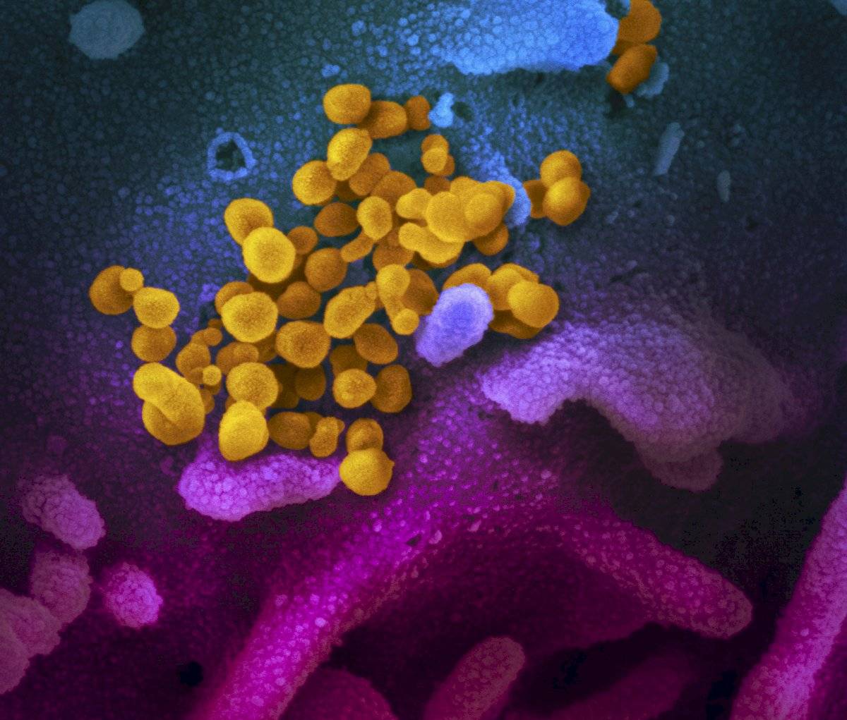 coronavirus laboratorio microscopio