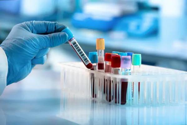 Coronavirus Francia Coronavirus Francia