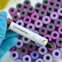 Comienzan hacer pruebas gratuitas de COVID-19