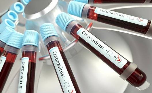 Prueba podrá detectar el coronavirus en 45 minutos