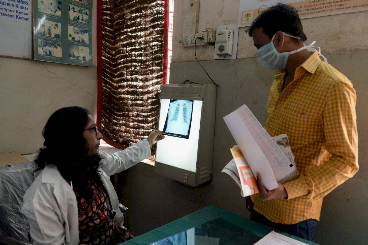 tuberculosis