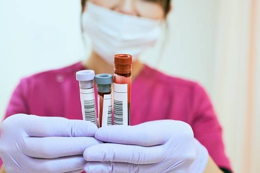 muestras de sangre de pacientes con COVID-19