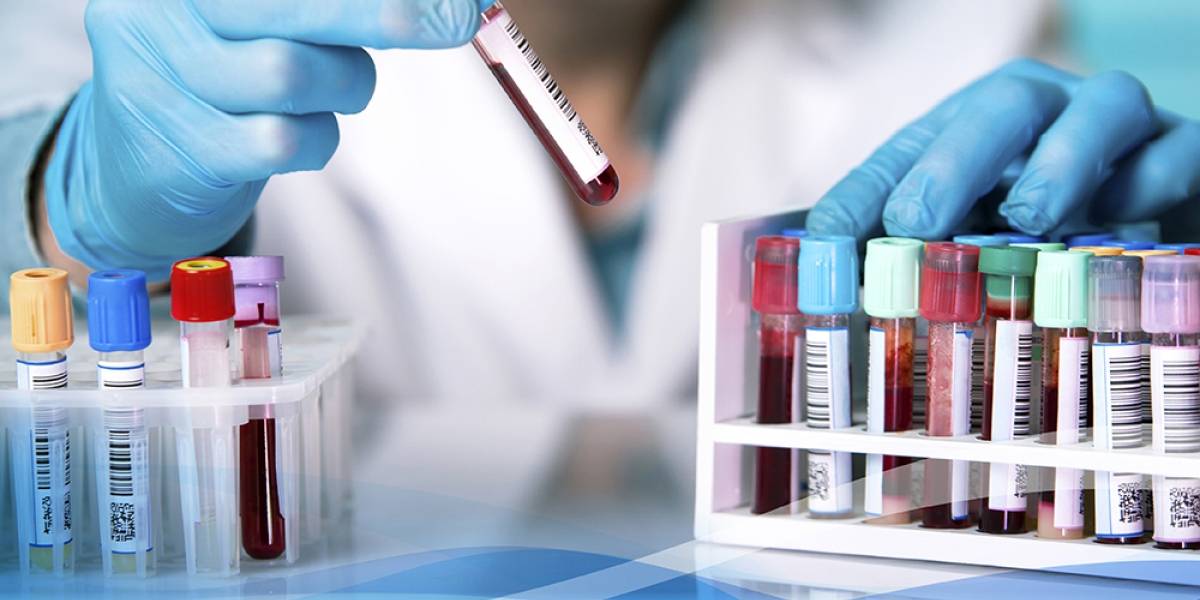 Coronavirus: ¿Cómo se produce una vacuna desde cero?