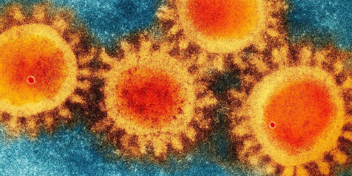 Coronavirus: virólogo que ganó el Nobel cree que el covid-19 proviene de un laboratorio