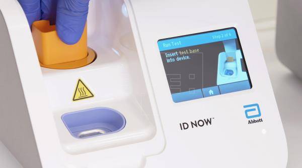 Coronavirus: crean nuevo test para identificar al COVID-19 en solo 5 minutos
