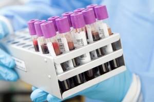 Científicos australianos identifican posible medicamento anti Covid-19 en pruebas de laboratorio