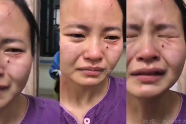 Paciente con COVID-19 golpea y muerde a enfermera en China