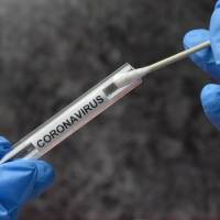Reportan siete muertes y 209 nuevos casos confirmados de COVID