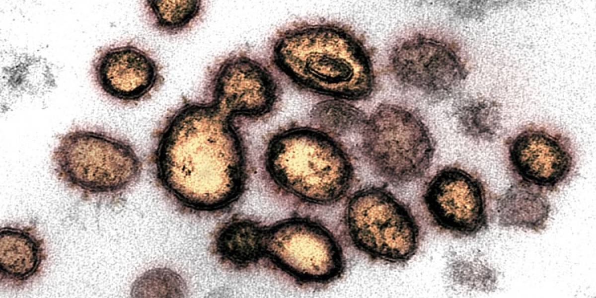 Coronavirus: imágenes oficiales revelan el momento exacto en que el COVID-19 ataca a una célula