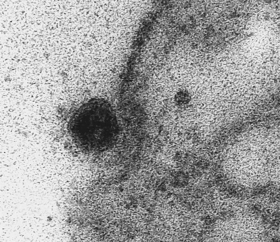 Brasil capta imágenes del momento exacto en que el coronavirus infecta una célula