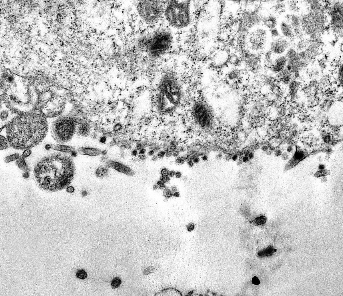 Coronavirus: imágenes oficiales revelan el momento exacto en que el COVID-19 ataca a una célula