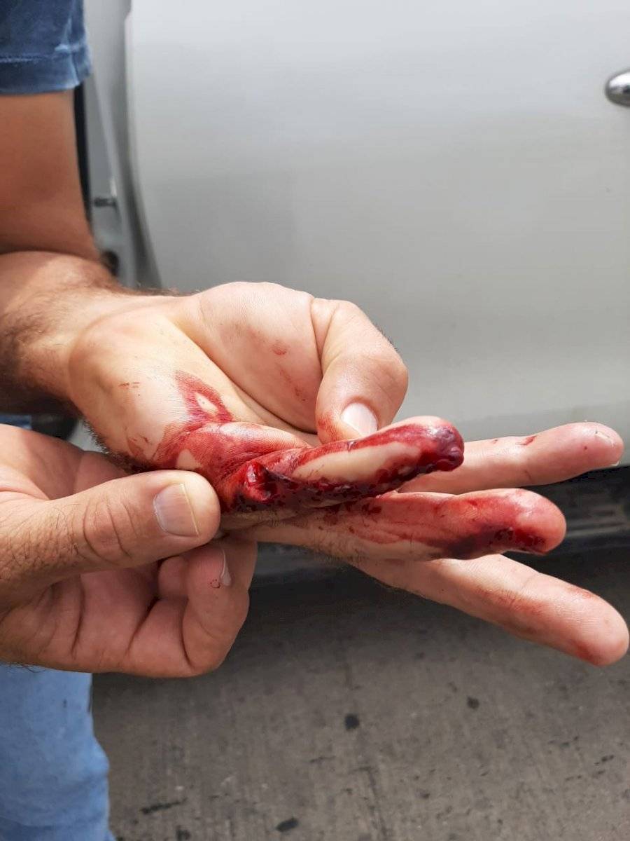 Tres Kiebres fue herido de machetazo