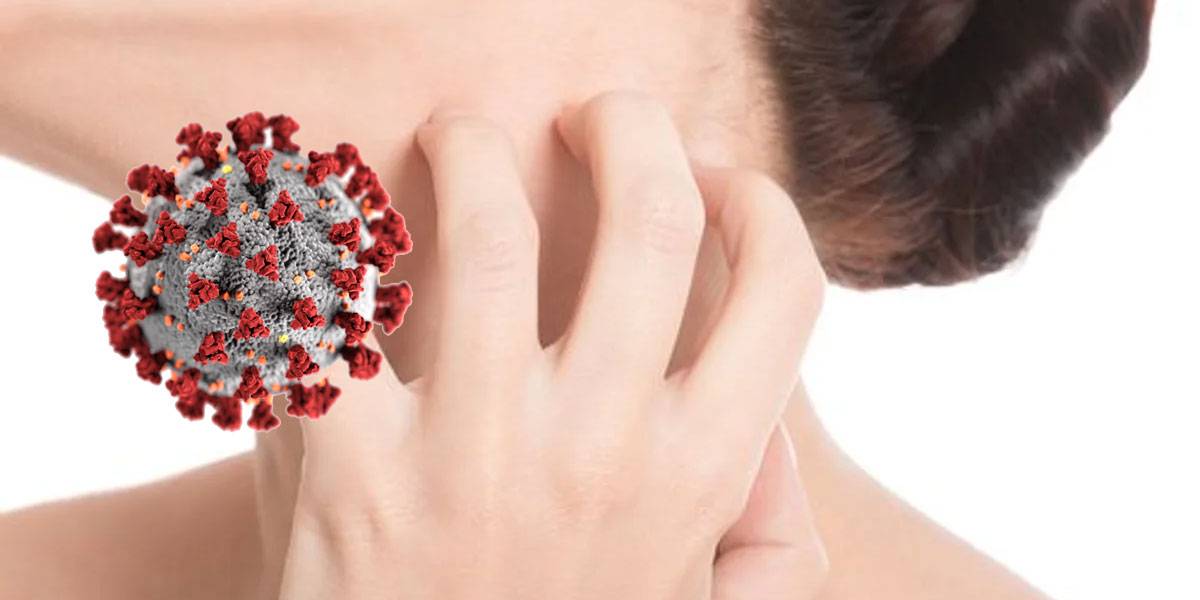 Coronavirus: así podrás diferenciar si una lesión de piel está relacionada con el COVID-19