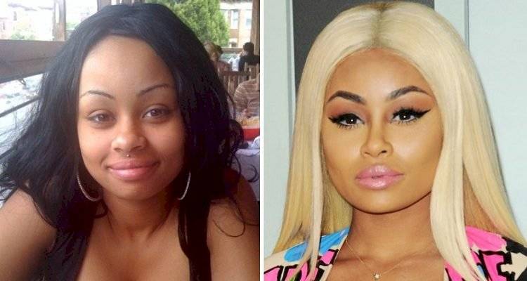 Blac Chyna: Yes, it was the transformation after the surgery to look like Kim Kardashian