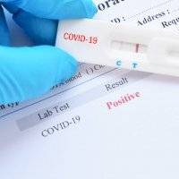 Coronavirus en Puerto Rico: Reportan ocho muertes y 2,337 casos adicionales