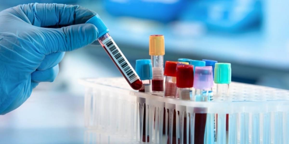 Un medicamento para la diabetes podría ser capaz de reducir el riesgo de Alzheimer