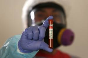 gravedad de los síntomas del coronavirus