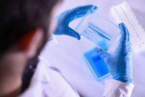 IMAGEN REFERENCIAL: Observación del gel que evalúa la pureza de los antígenos producidos en el laboratorio el 24 de marzo de 2020 en Belo Horizonte, Brasil.